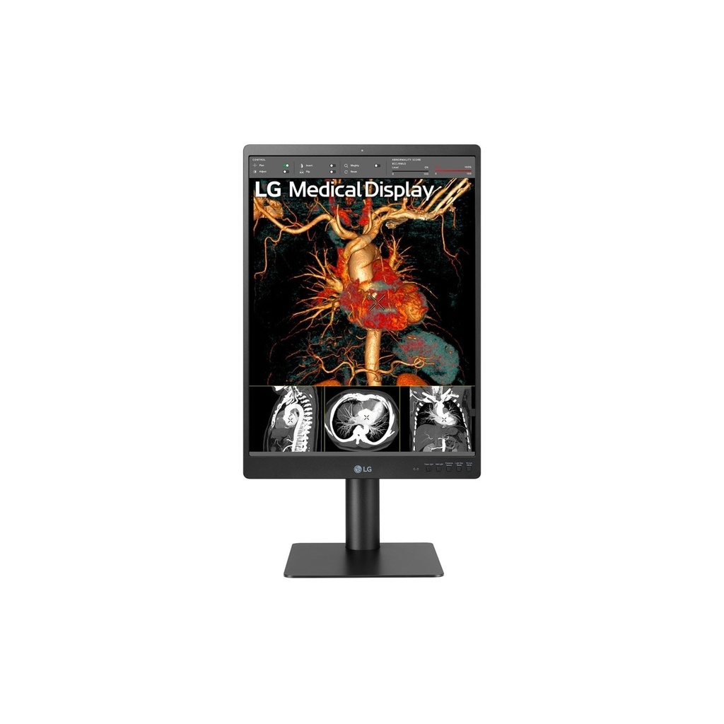 LG 21HQ513D-B Monitor Diagnostico Medico 21,3" 3MP IPS DICOM 1100cd/m²